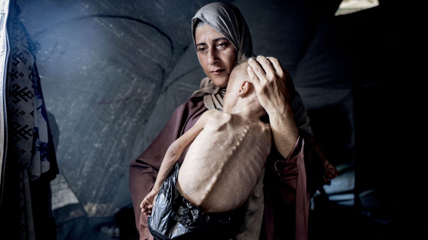 Starvation and Blockade: A Human Rights Perspective on Gaza